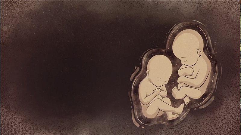 iBIBLE image of twins in utero